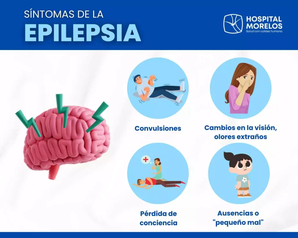 sintomas de la epilepsia infografia 