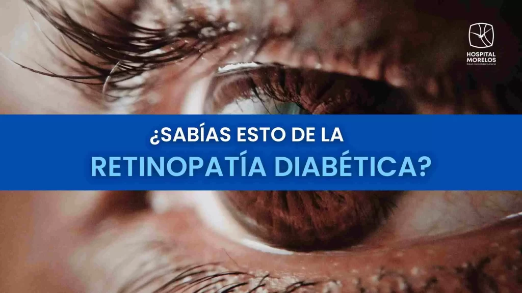 retinopatia diabetica hospital morelos