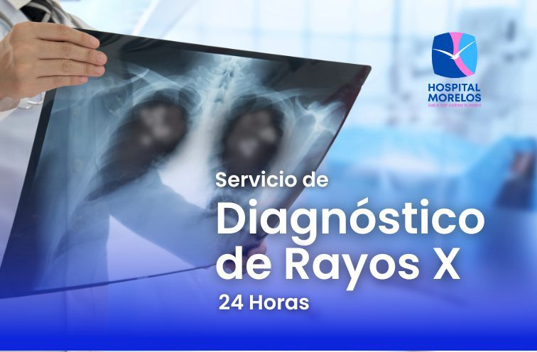 diagnóstico con rayos X